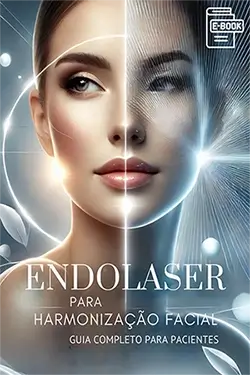 e-book - Endolaser para Harmonização Facial - Guia Completo da Clínica Saran - Dra. carolina Saran